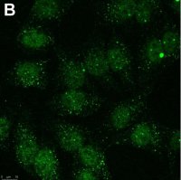 Anti-Linear Ubiquitin Antibody, clone 1E3 ZooMAb Rabbit Monoclonal 