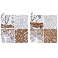Anti-LMOD1 antibody produced in rabbit 