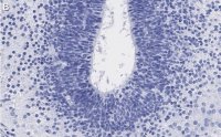 Anti-LMX-1 Antibody, clone 4L12, ZooMAb Rabbit Monoclonal 