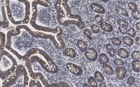 Anti-LONP1 Antibody, clone 1I18, ZooMAb Rabbit Monoclonal 