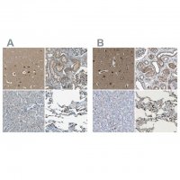 Anti-LPCAT1 antibody produced in rabbit 