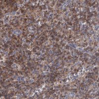 Anti-LRCH4 antibody produced in rabbit 