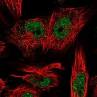 Anti-LRP5L antibody produced in rabbit 