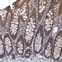 Anti-LRRC2 antibody produced in rabbit HPA039138-100UL