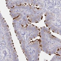 Anti-LRRC23 antibody produced in rabbit 