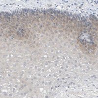 Anti-LRRC29 antibody produced in rabbit 
