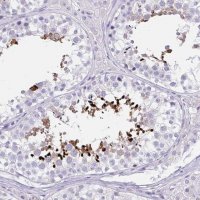 Anti-LRRC36 antibody produced in rabbit 