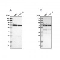 Anti-LRRC47 antibody produced in rabbit HPA008512-100UL