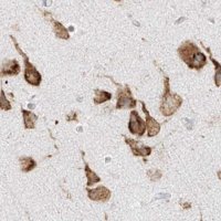 Anti-LRRC59 antibody produced in rabbit 