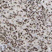Anti-LRRC61 antibody produced in rabbit 