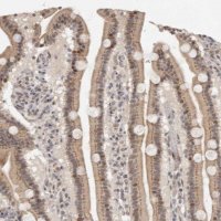 Anti-LRRC75A antibody produced in rabbit 