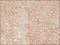 Anti-LRRK2 (C-terminal region) antibody produced in rabbit 