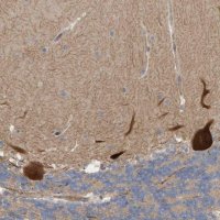 Anti-LRSAM1 antibody produced in rabbit 