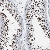 Anti-LRWD1 antibody produced in rabbit 