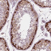 Anti-LSM14B antibody produced in rabbit 
