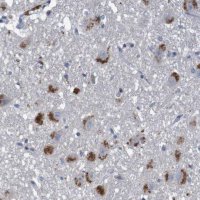 Anti-LTA antibody produced in rabbit 