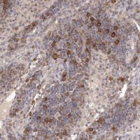 Anti-LTV1 antibody produced in rabbit 
