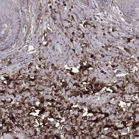Anti-LUM antibody produced in rabbit 