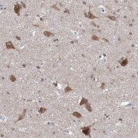 Anti-LURAP1 antibody produced in rabbit 