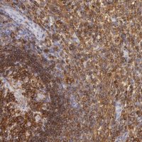 Anti-LYN antibody produced in rabbit 