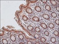 Anti-Lysyl Oxidase (C-terminal) antibody produced in rabbit 