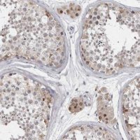 Anti-LZIC antibody produced in rabbit HPA028184-100UL