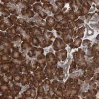 Anti-LZTS1 antibody produced in rabbit 