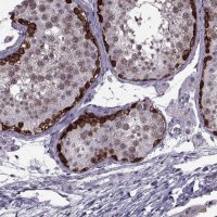 Anti-MAGEA4 antibody produced in rabbit 
