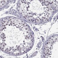Anti-MAGEB18 antibody produced in rabbit HPA046141-100UL