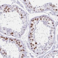 Anti-MAGEC2 antibody produced in rabbit 