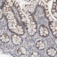 Anti-MAGEE2 antibody produced in rabbit 