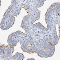 Anti-MAGI1 antibody produced in rabbit 