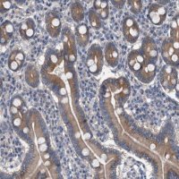 Anti-MAMDC2 antibody produced in rabbit 
