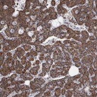 Anti-MAN2A1 antibody produced in rabbit 