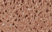 Anti-MAP2 Antibody, clone 3C19, ZooMAb Rabbit Monoclonal 