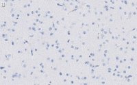 Anti-MAP2 Antibody, clone AP20 ZooMAb Mouse Monoclonal 