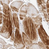 Anti-MAP2K5 antibody produced in rabbit 
