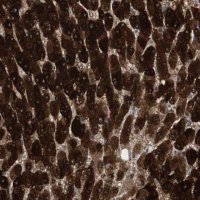 Anti-MAP4K4 antibody produced in rabbit 
