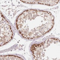 Anti-MAP7D2 antibody produced in rabbit 