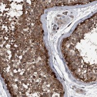 Anti-MAPKAP1 antibody produced in rabbit 