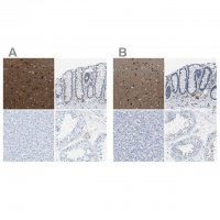 Anti-MAPRE2 antibody produced in rabbit 
