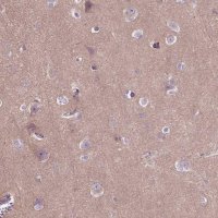 Anti-MAPT antibody produced in rabbit 