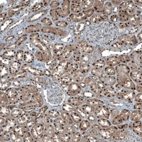 Anti-MAT2A antibody produced in rabbit HPA043028-100UL