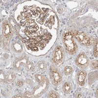 Anti-MAT2B antibody produced in rabbit HPA037721-100UL