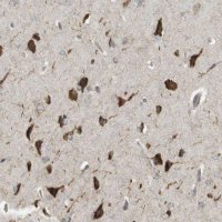 Anti-MBOAT2 antibody produced in rabbit HPA014836-100UL