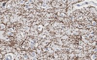 Anti-MBP Antibody, clone 2N6 , ZooMAb Rabbit Monoclonal 