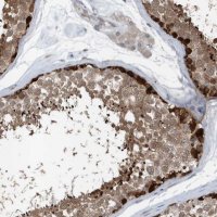 Anti-MCC antibody produced in rabbit 