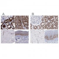Anti-MCCC2 antibody produced in rabbit 