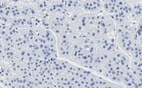 Anti-MDR-1 Antibody, clone 1O12 ZooMAb Rabbit Monoclonal 