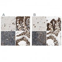Anti-ME2 antibody produced in rabbit 